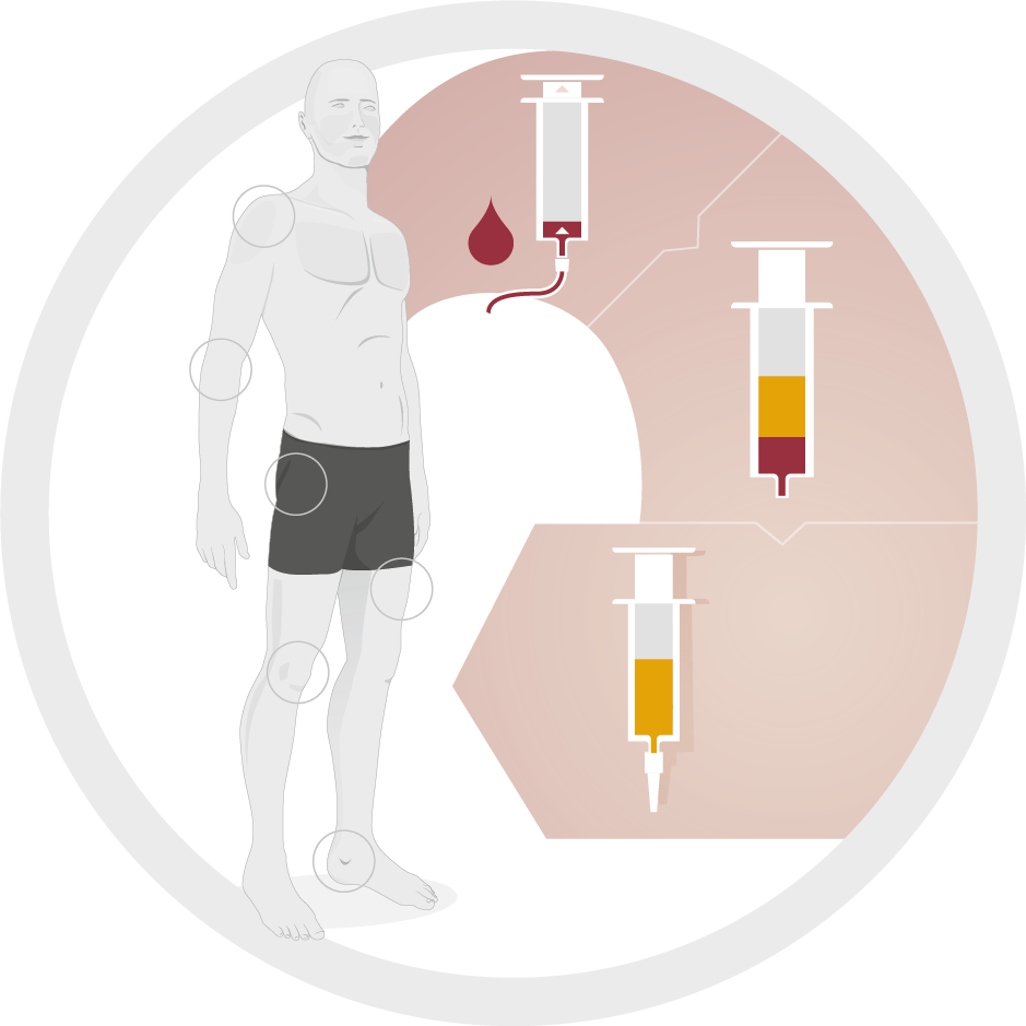 Gelenkzentrum ACP Therapie